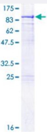 SDS PAGE (METTL3-838H).jpg